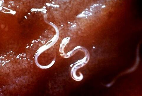 παράσιτα μέσα στο σώμα